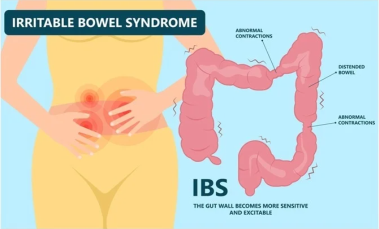 Specialist IBS Treatment Clinic in Kailash Nagar
